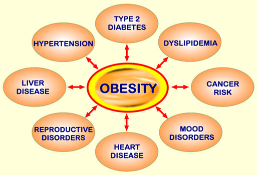 Obesity causes