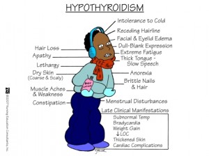 hypothyroidism2