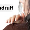 how to remove dandruff