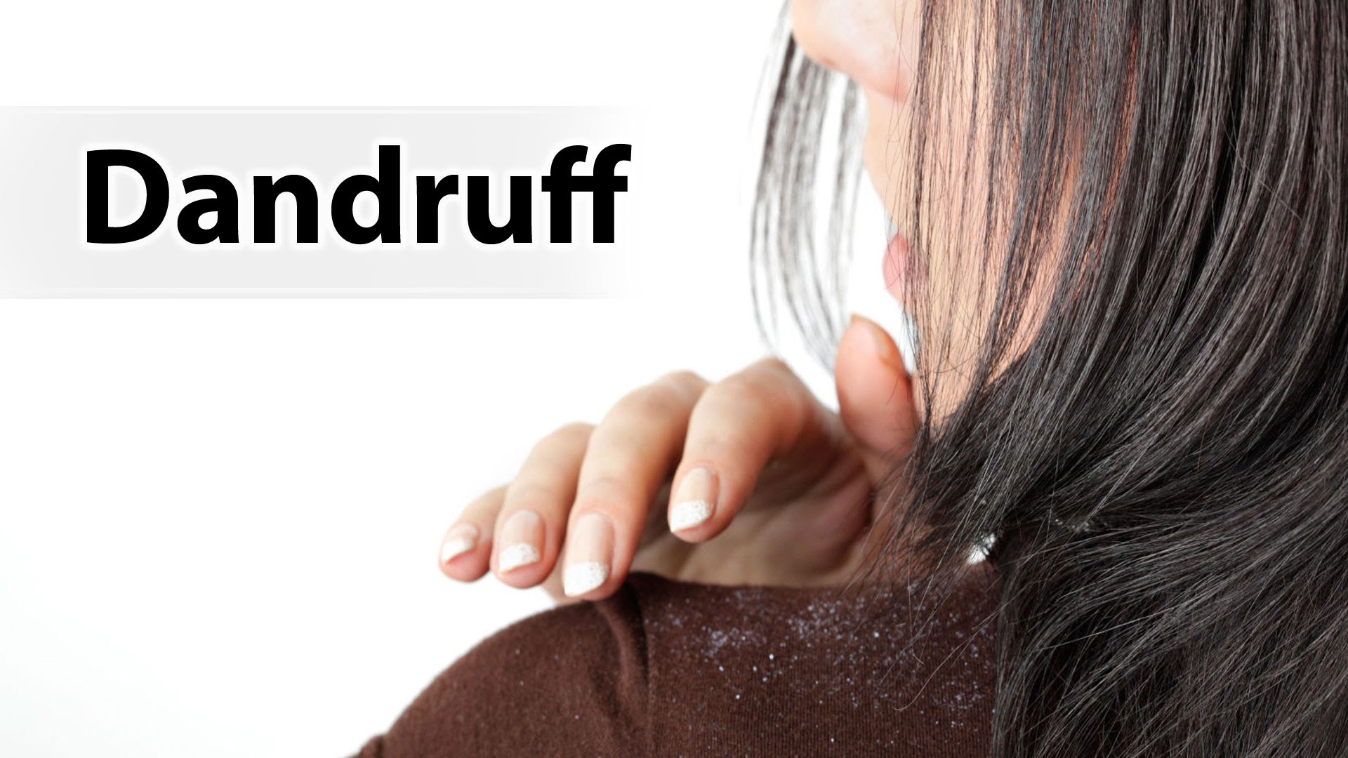 how to remove dandruff