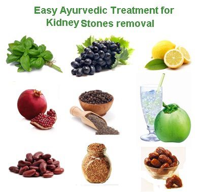 home remedies to treat kidney stones